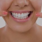 tipos de blanqueamiento dental