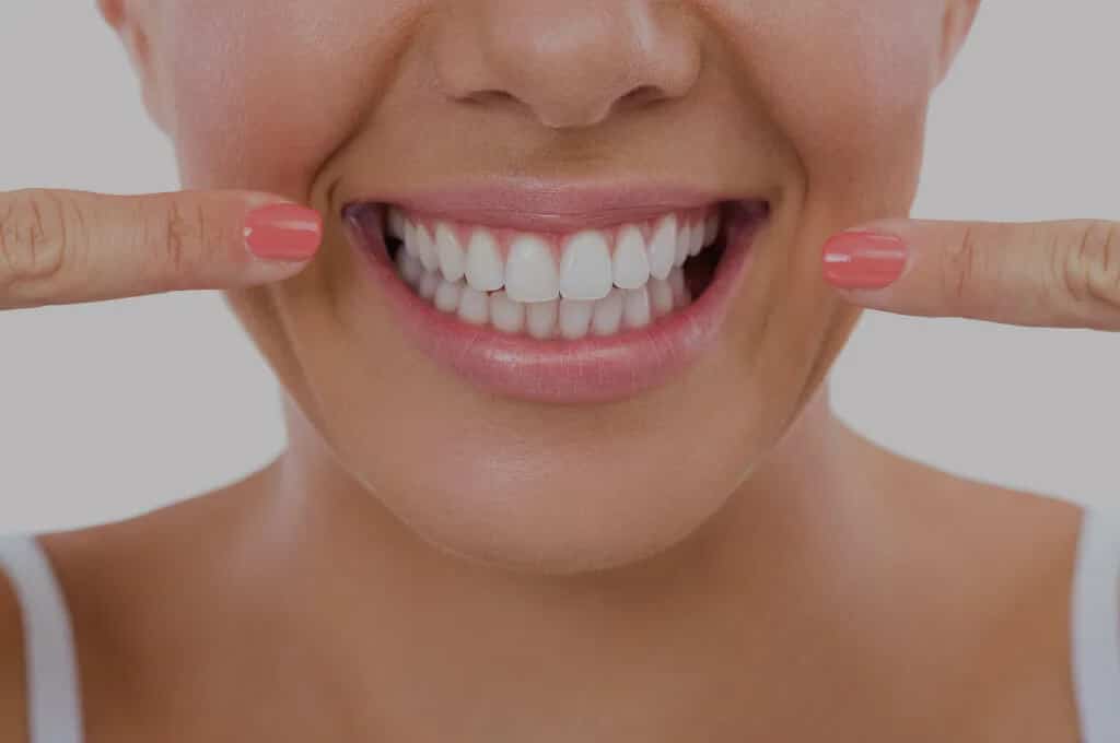 tipos de blanqueamiento dental